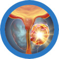 caprostata